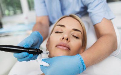 Microneedling- what are the benefits?