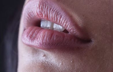 Best Lip Fillers