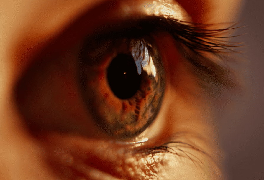 Best treatments for Dark Circles under eyes