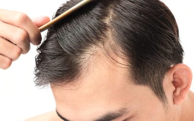 PRP for Hair Loss and Hair Thinning in Men: A Guide to Boosting Hair Growth