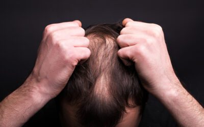 Battling Hair Thinning with Innovative Solutions