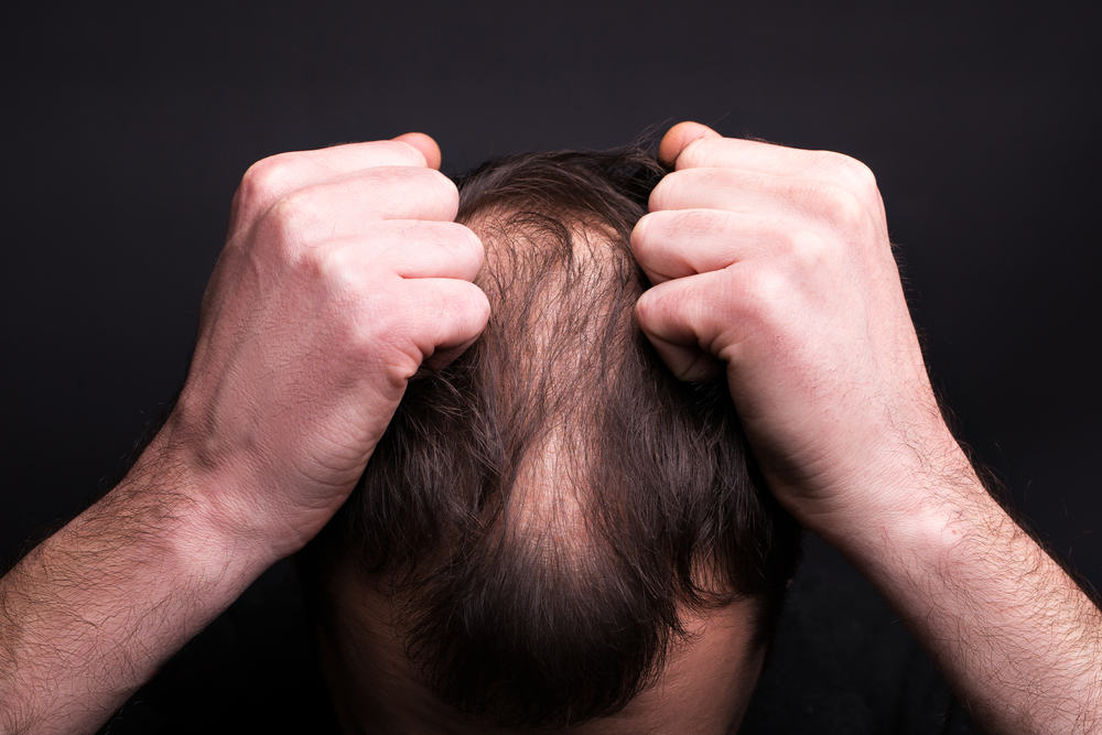 Battling Hair Thinning with Innovative Solutions