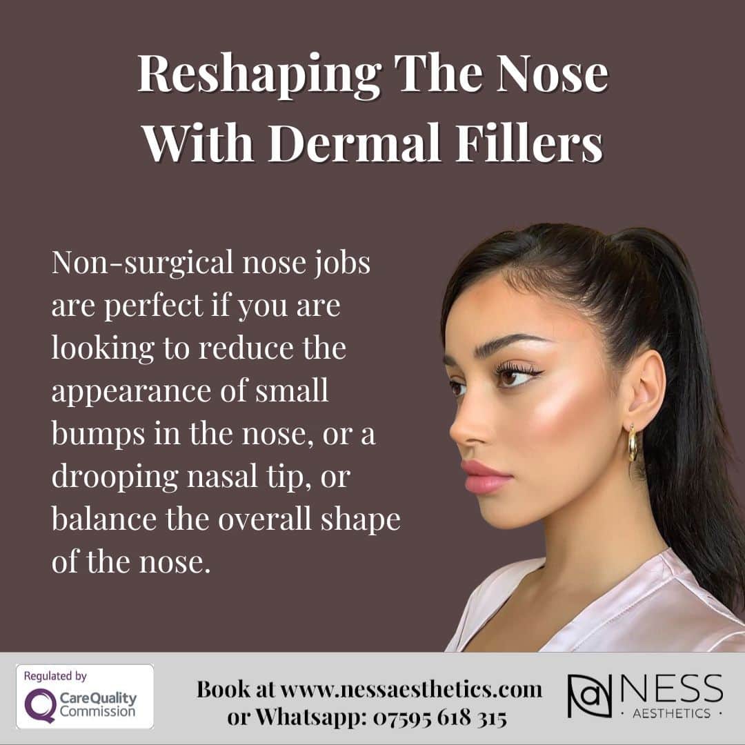 The benefits of a non surgical nose job