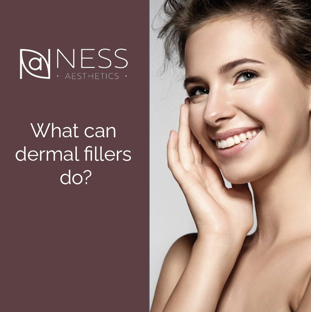 What Can Dermal Fillers Do?