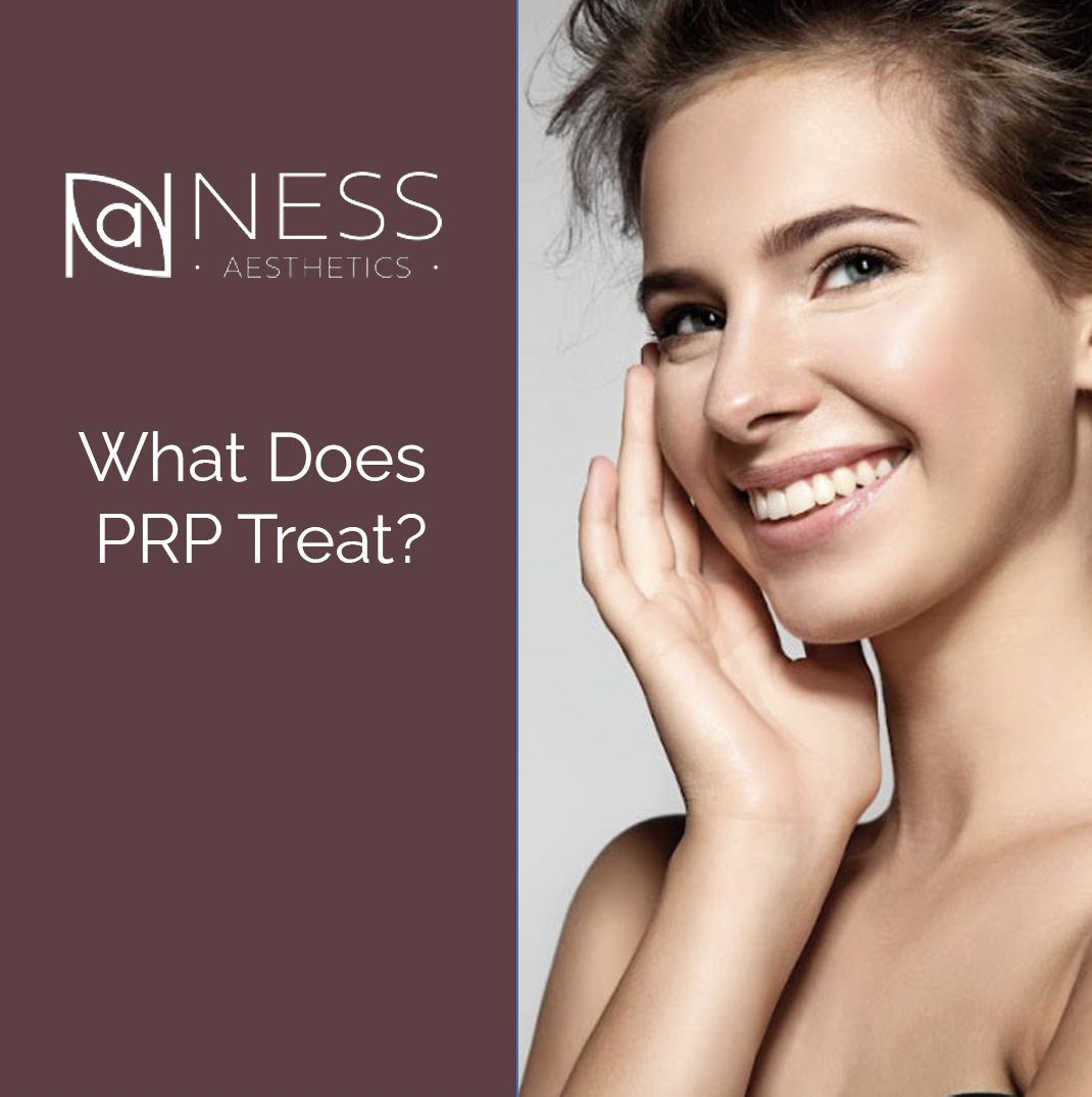 What does PRP treat?