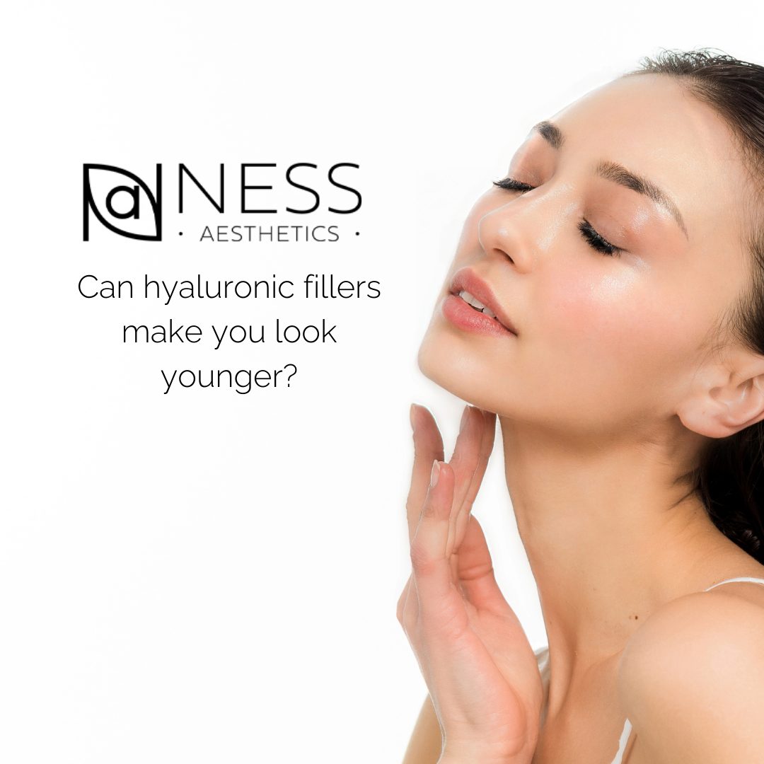 Can hyaluronic fillers make you look younger?