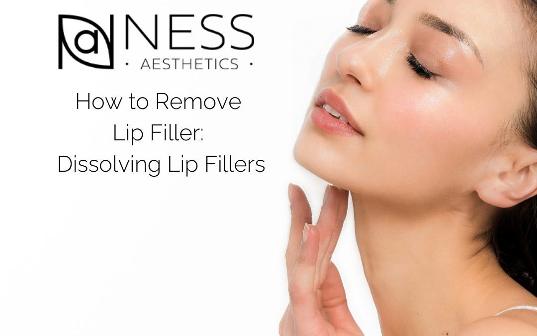 How to Remove Lip Filler: Dissolving Lip Fillers