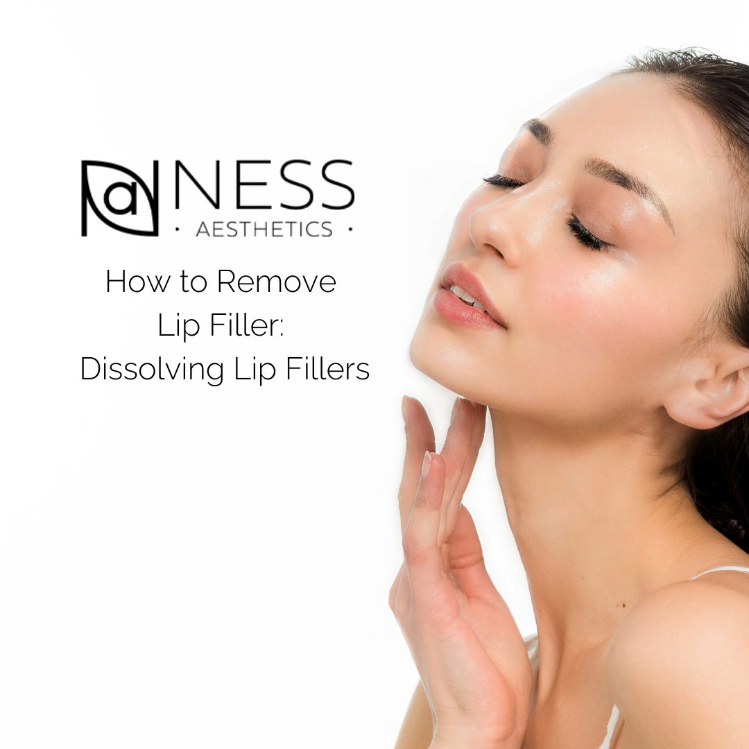 How to Remove Lip Filler: Dissolving Lip Fillers