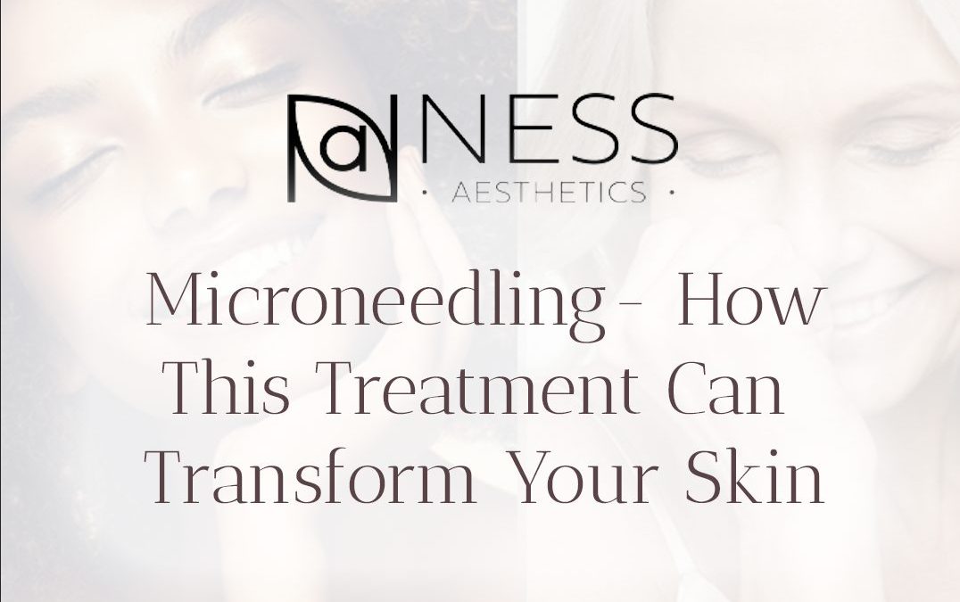 microneedling