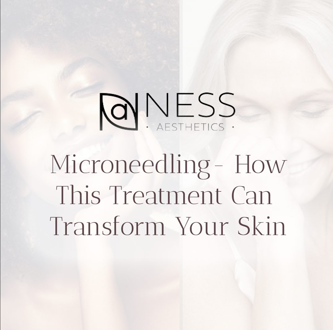 The Rise of Microneedling: How This Treatment Can Transform Your Skin