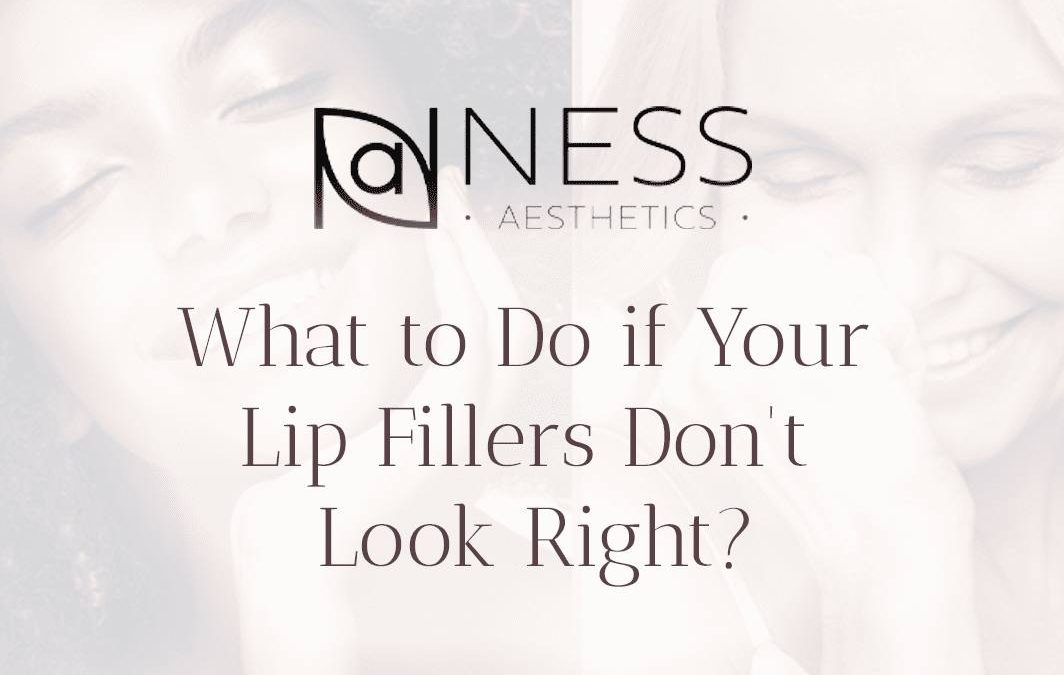 What to Do if Your Lip Fillers Don’t Look Right