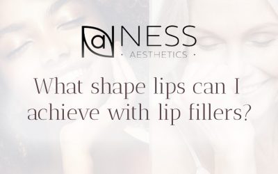 What shape lips can I achieve with lip fillers?