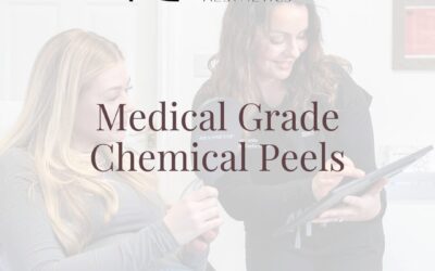 Medical Grade Chemical Peels