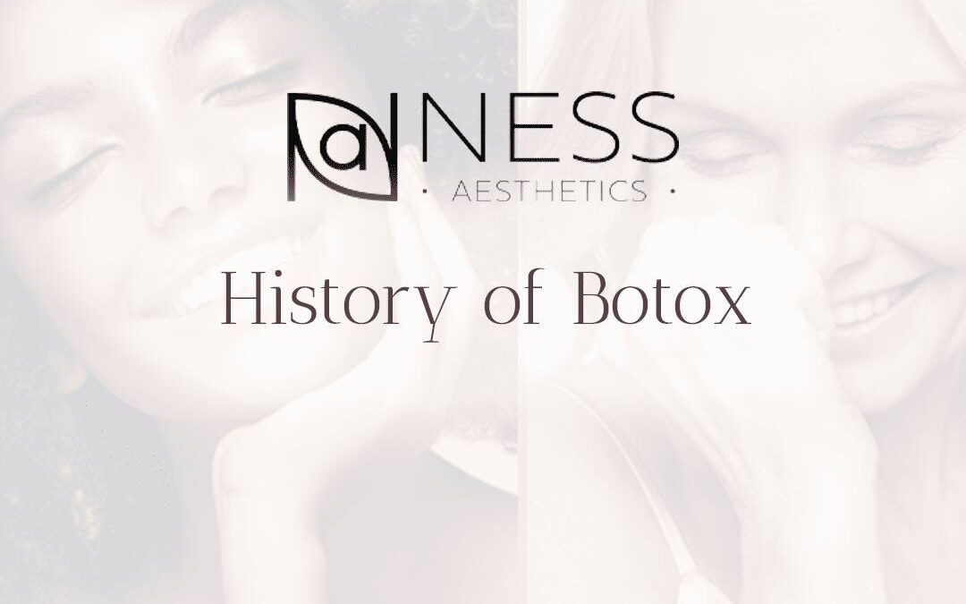 History of Botox