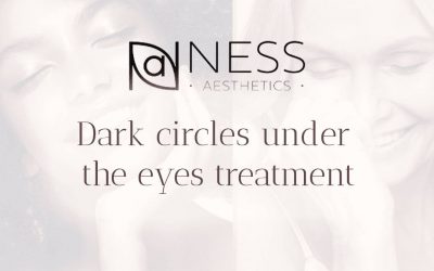 Dark circle under the eyes treatment